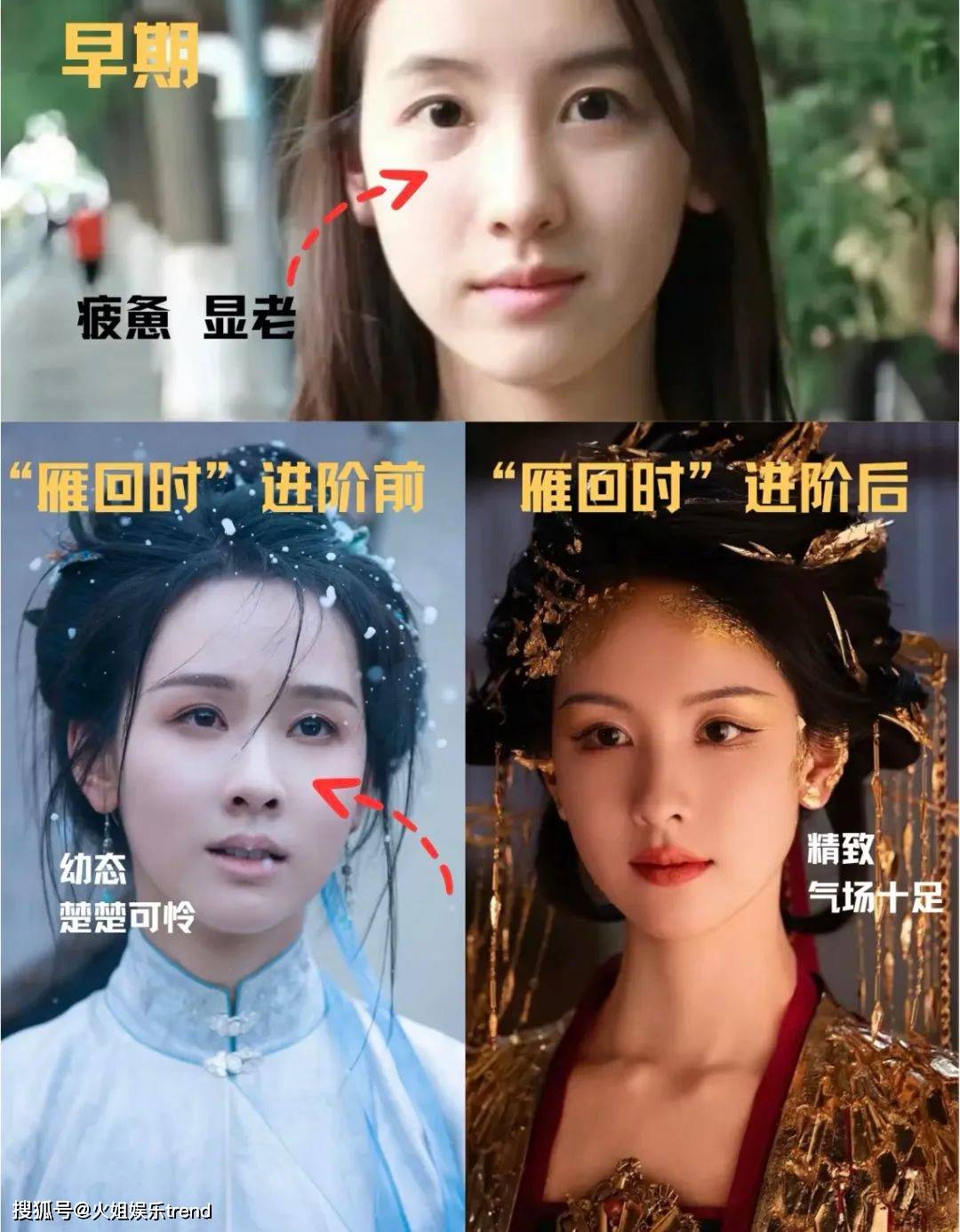 陈都灵是不是医美了？